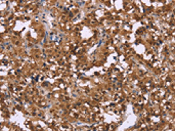 Rabbit Polyclonal Antibody to GPR171