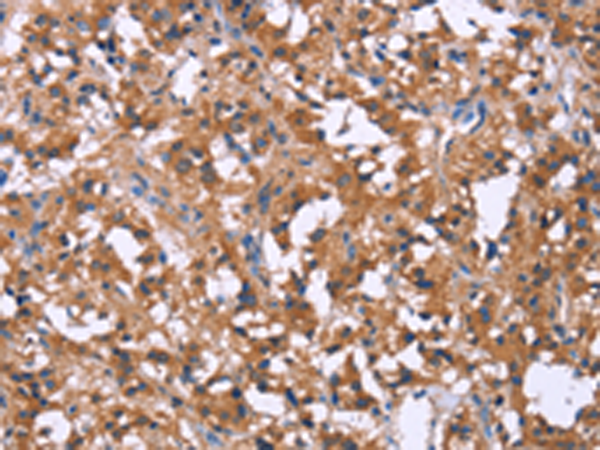 Rabbit Polyclonal Antibody to SLC52A1