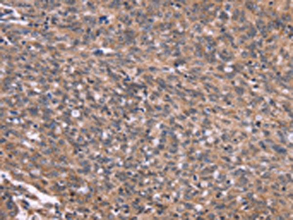Rabbit Polyclonal Antibody to GPR65
