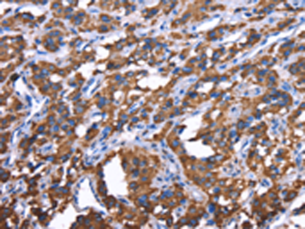 Rabbit Polyclonal Antibody to GREB1