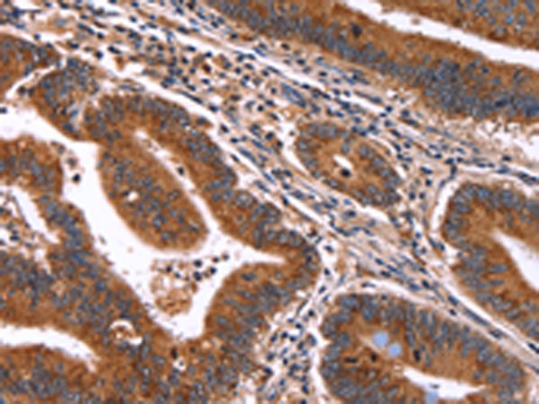 Rabbit Polyclonal Antibody to HACE1