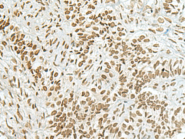 Rabbit Polyclonal Antibody to HAS1