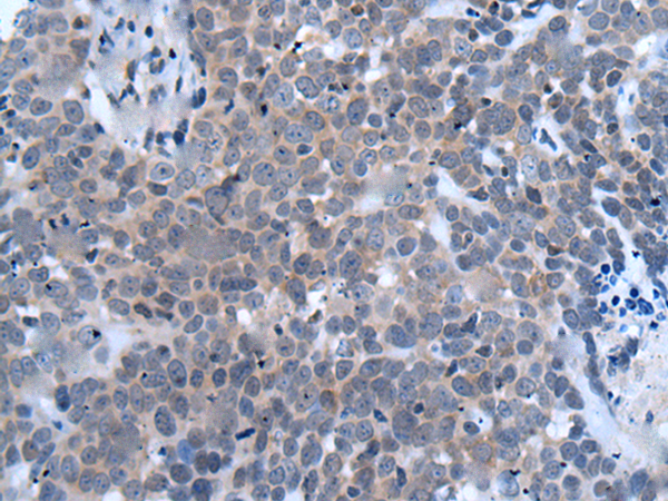 Rabbit Polyclonal Antibody to HES1