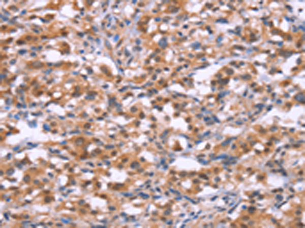 Rabbit Polyclonal Antibody to BRK1