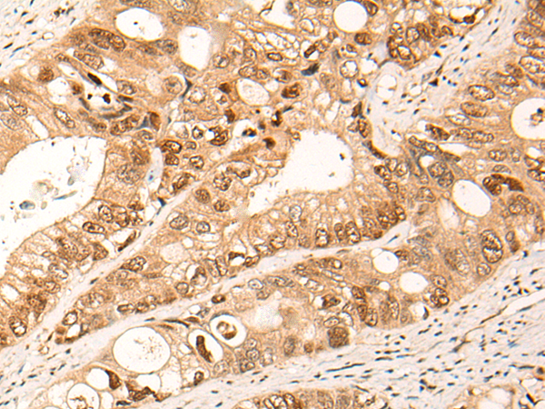 Rabbit Polyclonal Antibody to HIPK2