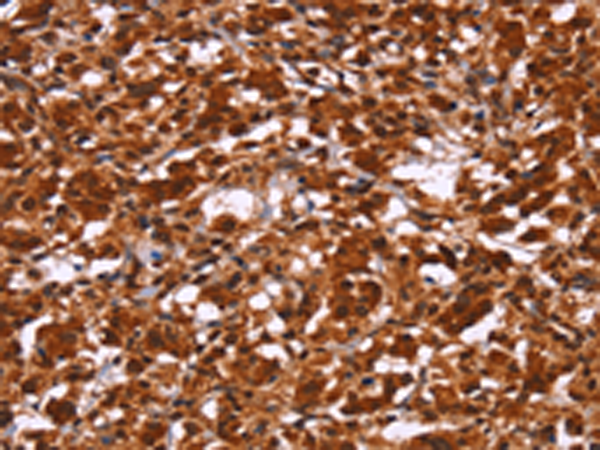 Rabbit Polyclonal Antibody to HIPK1