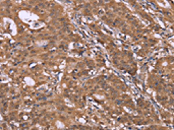 Rabbit Polyclonal Antibody to HLTF