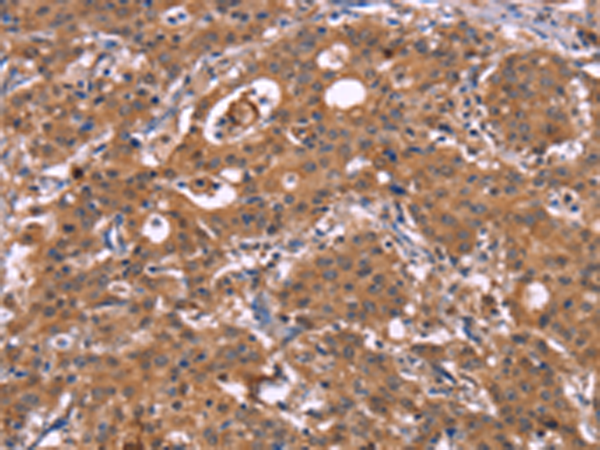 Rabbit Polyclonal Antibody to HMGCS1