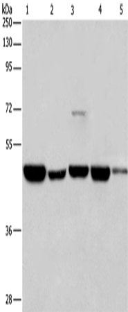 Rabbit Polyclonal Antibody to HNRNPF