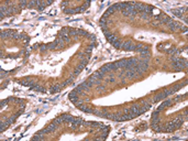 Rabbit Polyclonal Antibody to HRG