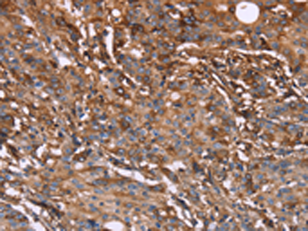 Rabbit Polyclonal Antibody to HP