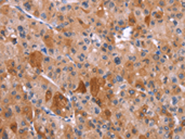 Rabbit Polyclonal Antibody to HRH1