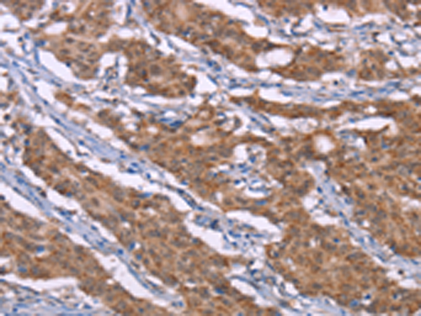 Rabbit Polyclonal Antibody to HRH3
