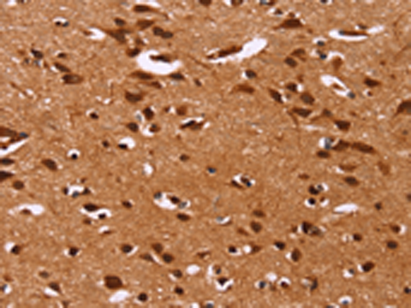 Rabbit Polyclonal Antibody to HRK
