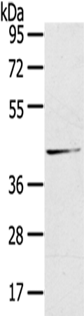 Rabbit Polyclonal Antibody to HSD11B2