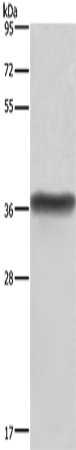 Rabbit Polyclonal Antibody to HSD17B1