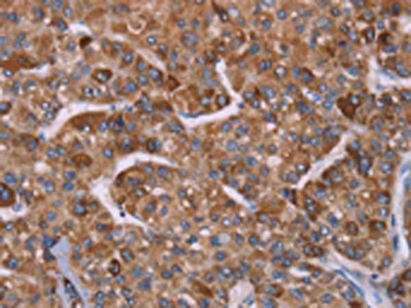 Rabbit Polyclonal Antibody to HSPE1