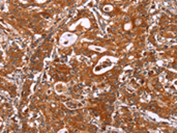 Rabbit Polyclonal Antibody to ICAM3