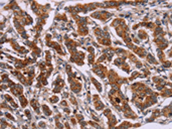 Rabbit Polyclonal Antibody to ID2
