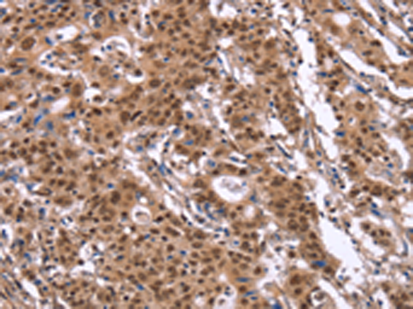 Rabbit Polyclonal Antibody to ID4