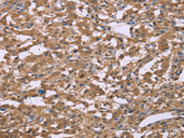 Rabbit Polyclonal Antibody to IFNA2