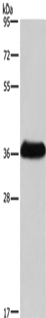 Rabbit Polyclonal Antibody to IFNGR2