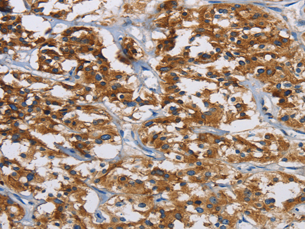 Rabbit Polyclonal Antibody to IGF2R
