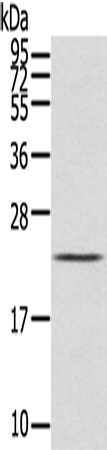 Rabbit Polyclonal Antibody to IL31