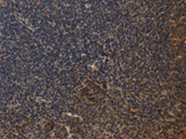 Rabbit Polyclonal Antibody to CYBA