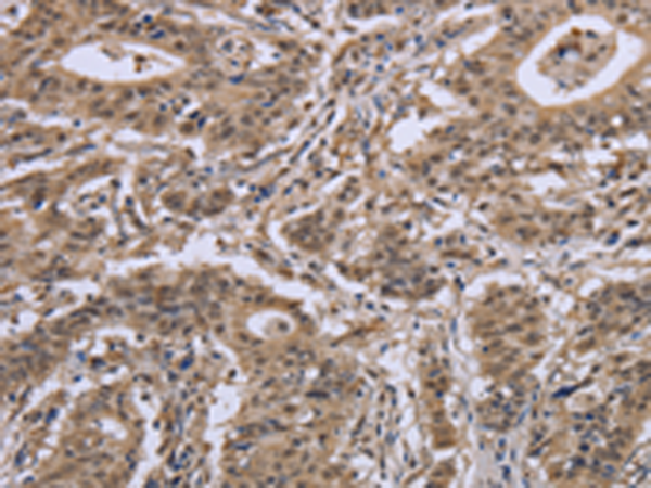 Rabbit Polyclonal Antibody to IPO8