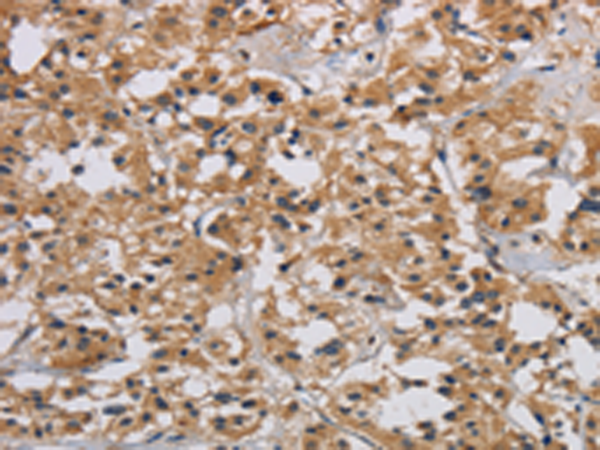 Rabbit Polyclonal Antibody to INPPL1