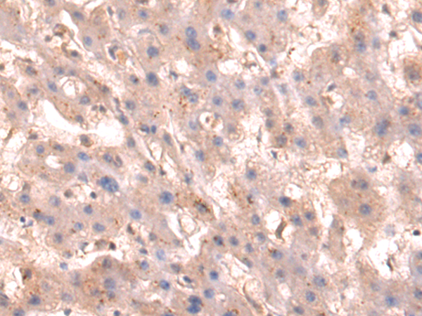 Rabbit Polyclonal Antibody to ITGA11