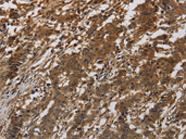 Rabbit Polyclonal Antibody to ITGB7