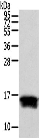 Rabbit Polyclonal Antibody to FABP1