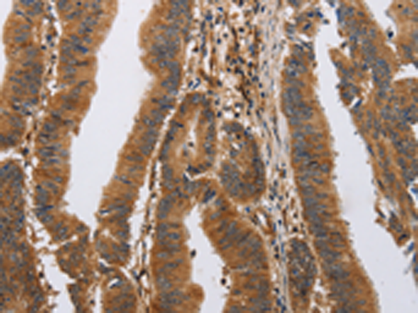 Rabbit Polyclonal Antibody to ITPR1