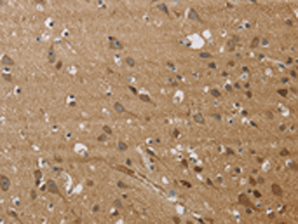 Rabbit Polyclonal Antibody to JAG1