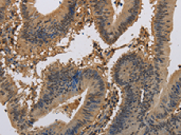 Rabbit Polyclonal Antibody to KCNA7