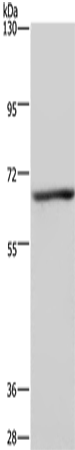 Rabbit Polyclonal Antibody to KCND1