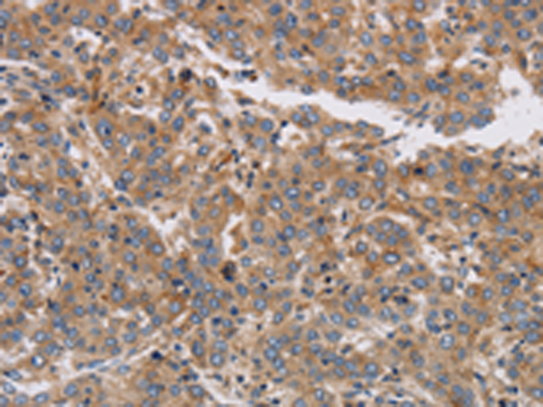 Rabbit Polyclonal Antibody to KCNG1