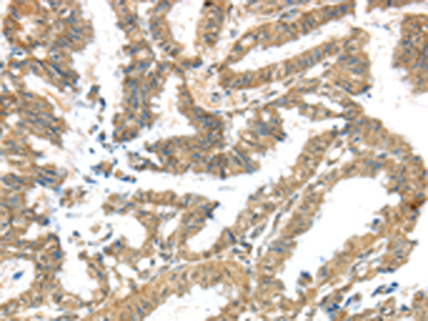 Rabbit Polyclonal Antibody to KCNG3