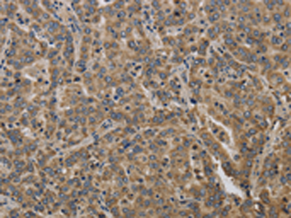 Rabbit Polyclonal Antibody to KCNMB2