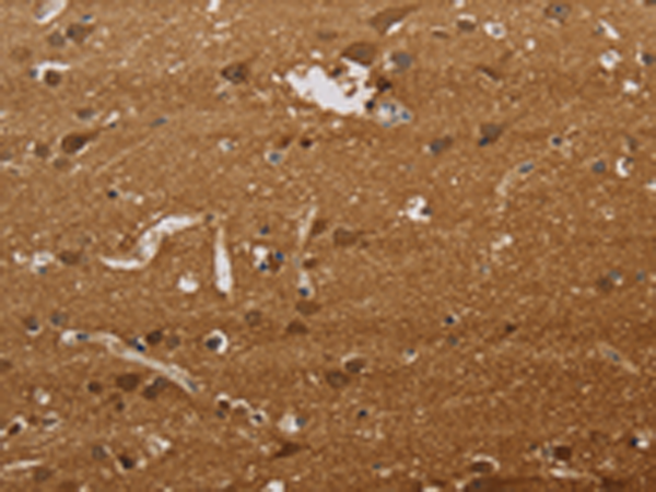 Rabbit Polyclonal Antibody to ELAVL2