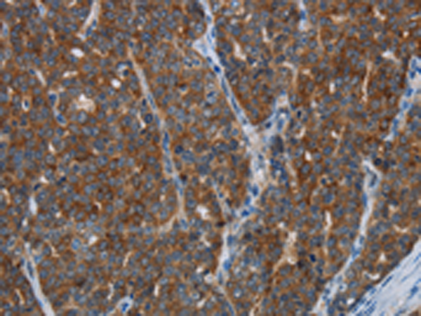 Rabbit Polyclonal Antibody to KISS1R