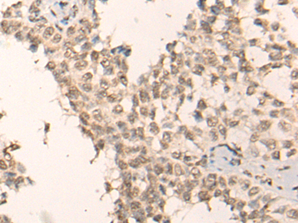 Rabbit Polyclonal Antibody to KLF2