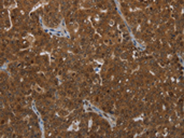 Rabbit Polyclonal Antibody to KLRF1