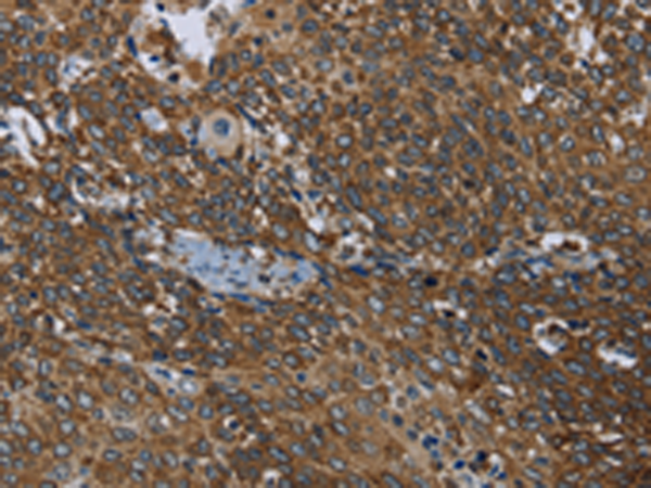Rabbit Polyclonal Antibody to PRDM2