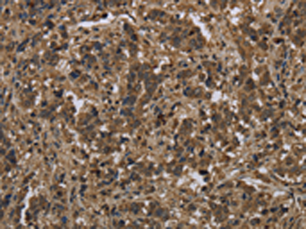Rabbit Polyclonal Antibody to KSR1