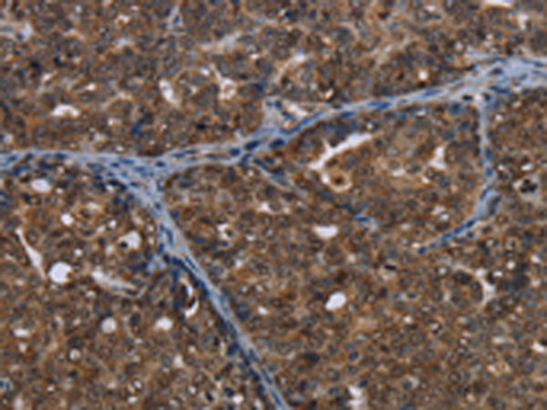 Rabbit Polyclonal Antibody to CERS6