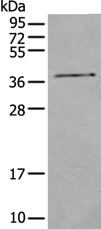 Rabbit Polyclonal Antibody to CNMD