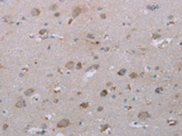 Rabbit Polyclonal Antibody to LIMK1